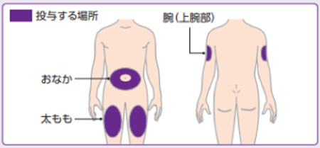 マンジャロ注射