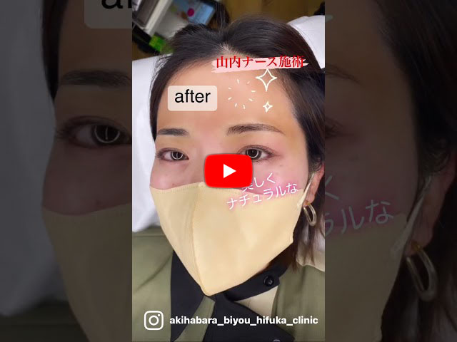 医療用アートメイクとは